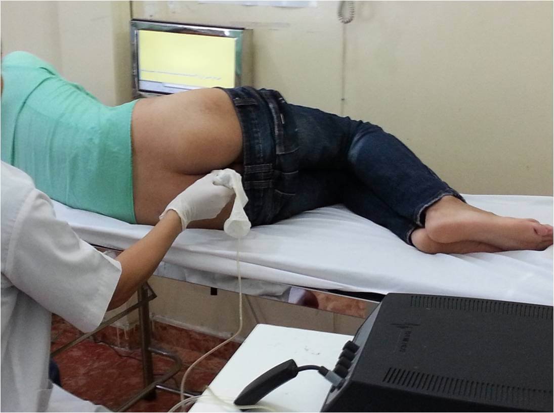 Đi ngoài ra nhiều máu: Phải làm gì? 3