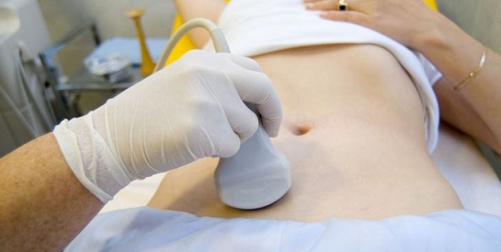 Siêu âm có phát hiện u nang buồng trứng?