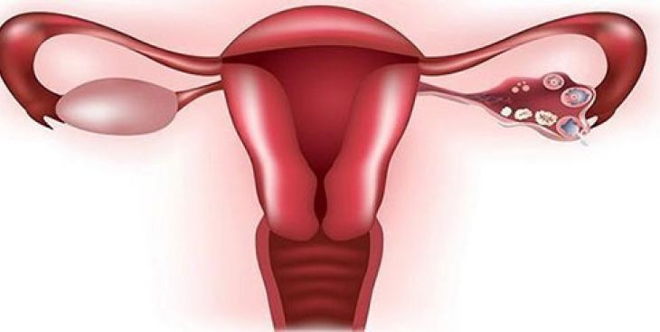 Nang cơ năng: Dấu hiệu nhận biết & mức độ nguy hiểm