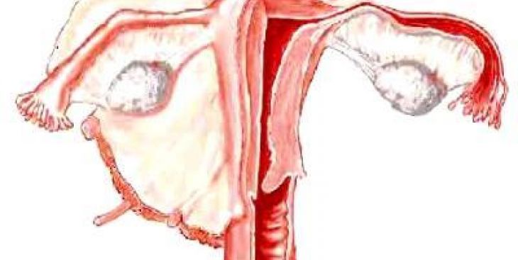 Tìm hiểu về nang hoàng tuyến và cách điều trị bệnh đơn giản