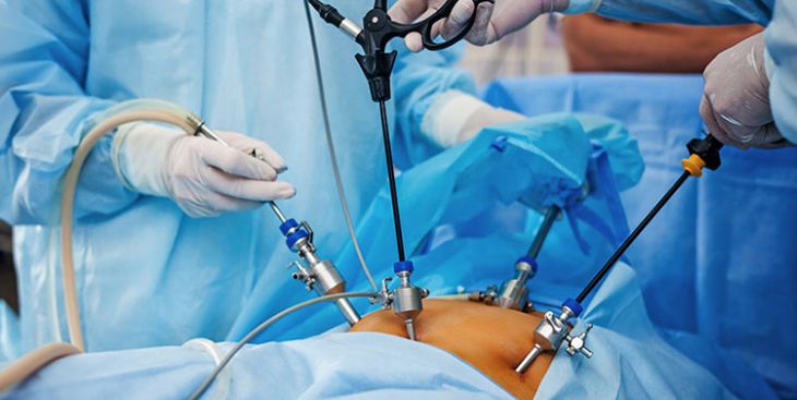 Nội soi buồng trứng và những điều cần lưu ý sau nội soi