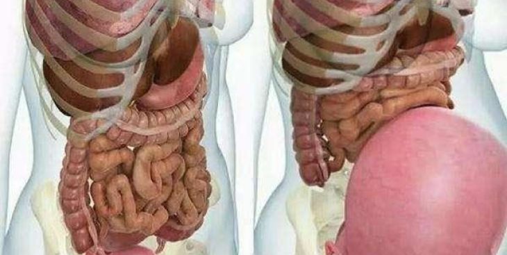 Tìm hiểu về sự ảnh hưởng của u bì buồng trứng khi mang thai 